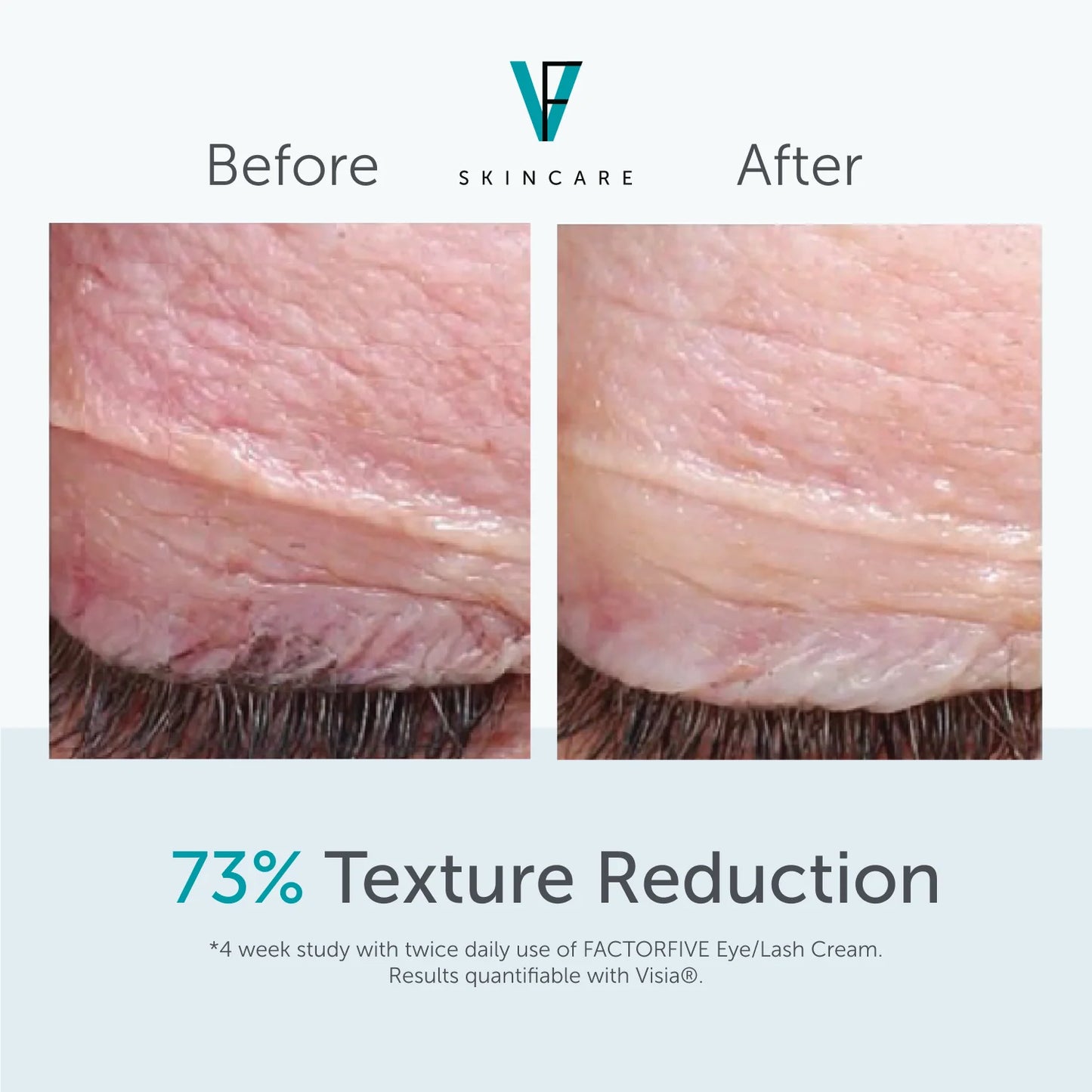 EYE/LASH CREAM
