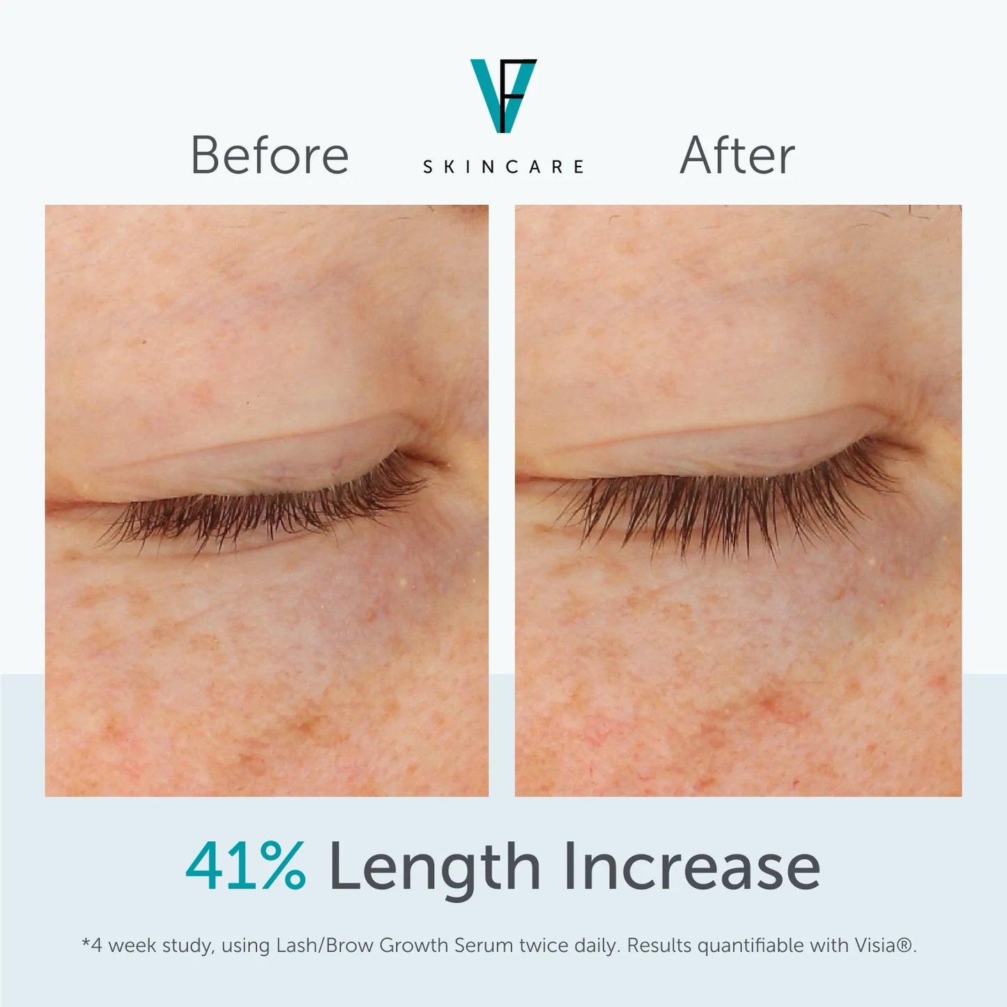Lash/ Brow Growth Serum